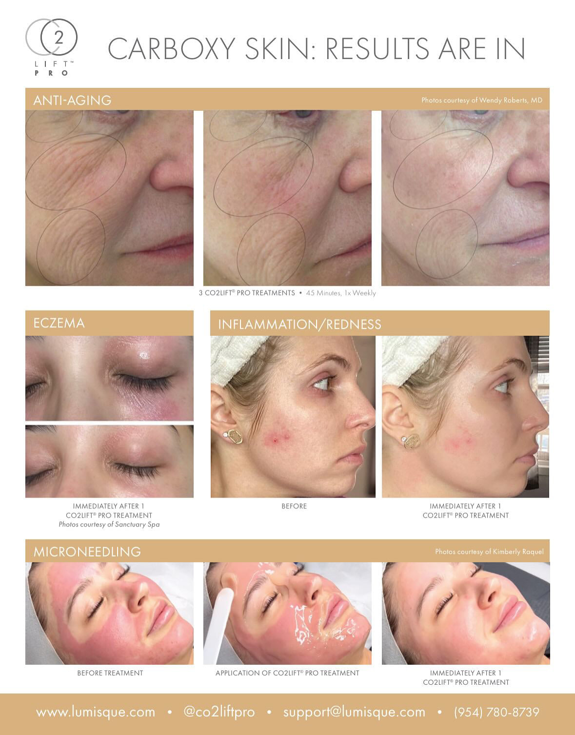 CO2Lift Pro Carboxy Gel Treatment - 3 Treatments