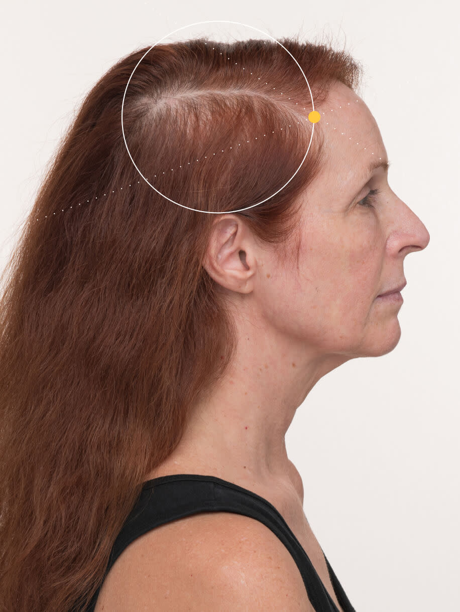 the best hair supplement for hair growth