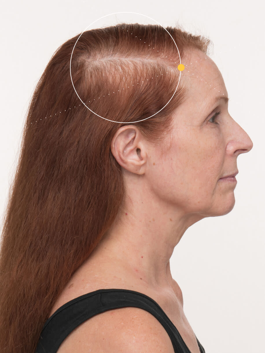 hair vitamins for growth